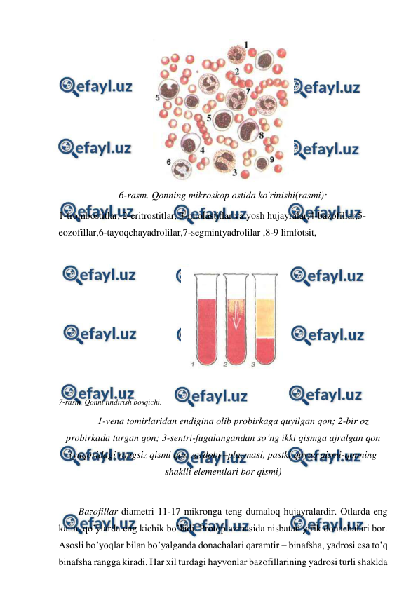  
 
 
6-rasm. Qonning mikroskop ostida ko'rinishi(rasmi): 
1-trombostitlar, 2-eritrostitlar, 3-miolastitlar va yosh hujayralar,4-bazofillar,5-
eozofillar,6-tayoqchayadrolilar,7-segmintyadrolilar ,8-9 limfotsit, 
 
 
 
7-rasm. Qonni tindirish bosqichi. 
1-vena tomirlaridan endigina olib probirkaga quyilgan qon; 2-bir oz 
probirkada turgan qon; 3-sentri-fugalangandan so’ng ikki qismga ajralgan qon 
(yuqoridagi rangsiz qismi qon zardobi –plazmasi, pastki quyuq qismi-qonning 
shaklli elementlari bor qismi) 
 
Bazofillar diametri 11-17 mikronga teng dumaloq hujayralardir. Otlarda eng 
katta, qo’ylarda eng kichik bo’ladi. Protoplazmasida nisbatan yirik donachalari bor. 
Asosli bo’yoqlar bilan bo’yalganda donachalari qaramtir – binafsha, yadrosi esa to’q 
binafsha rangga kiradi. Har xil turdagi hayvonlar bazofillarining yadrosi turli shaklda 
