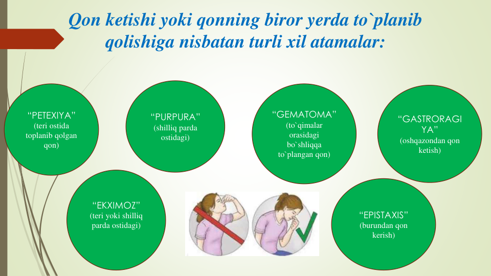 Qon ketishi yoki qonning biror yerda to`planib
qolishiga nisbatan turli xil atamalar:
“PETEXIYA”
(teri ostida
toplanib qolgan
qon)
“GASTRORAGI
YA”
(oshqazondan qon
ketish)
“PURPURA”
(shilliq parda
ostidagi)
“EKXIMOZ”
(teri yoki shilliq
parda ostidagi)
“GEMATOMA”
(to`qimalar
orasidagi
bo`shliqqa
to`plangan qon)
“EPISTAXIS”
(burundan qon
kerish)
