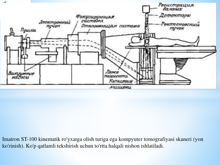 Imatron ST-100 kinematik ro'yxatga olish turiga ega kompyuter tomografiyasi skaneri (yon 
ko'rinish). Ko'p qatlamli tekshirish uchun to'rtta halqali nishon ishlatiladi.
