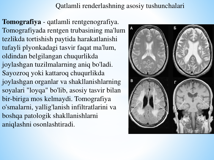 Tomografiya - qatlamli rentgenografiya. 
Tomografiyada rentgen trubasining ma'lum 
tezlikda tortishish paytida harakatlanishi 
tufayli plyonkadagi tasvir faqat ma'lum, 
oldindan belgilangan chuqurlikda 
joylashgan tuzilmalarning aniq bo'ladi. 
Sayozroq yoki kattaroq chuqurlikda 
joylashgan organlar va shakllanishlarning 
soyalari "loyqa" bo'lib, asosiy tasvir bilan 
bir-biriga mos kelmaydi. Tomografiya 
o'smalarni, yallig'lanish infiltratlarini va 
boshqa patologik shakllanishlarni 
aniqlashni osonlashtiradi.
Qatlamli renderlashning asosiy tushunchalari
