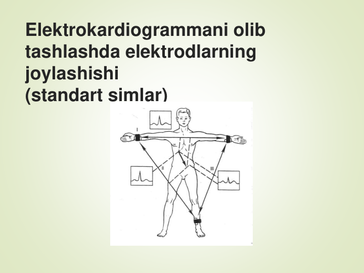 Elektrokardiogrammani olib 
tashlashda elektrodlarning 
joylashishi 
(standart simlar)
