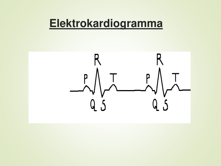 Elektrokardiogramma
