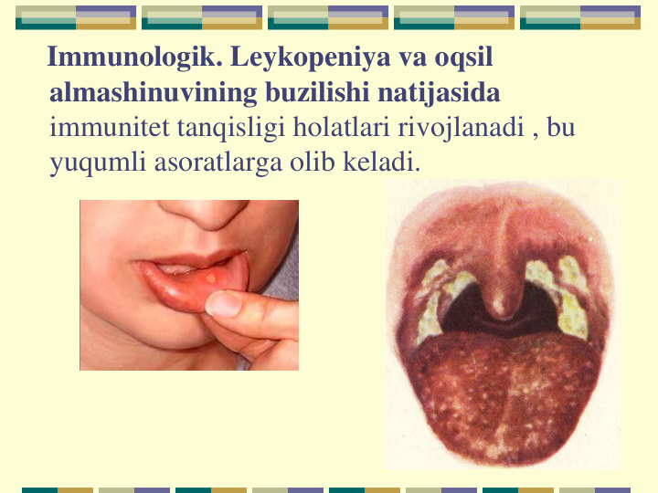 Immunologik. Leykopeniya va oqsil 
almashinuvining buzilishi natijasida 
immunitet tanqisligi holatlari rivojlanadi , bu 
yuqumli asoratlarga olib keladi.
