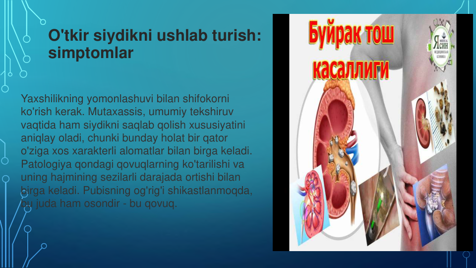 O'tkir siydikni ushlab turish: 
simptomlar
Yaxshilikning yomonlashuvi bilan shifokorni
ko'rish kerak. Mutaxassis, umumiy tekshiruv
vaqtida ham siydikni saqlab qolish xususiyatini
aniqlay oladi, chunki bunday holat bir qator
o'ziga xos xarakterli alomatlar bilan birga keladi.
Patologiya qondagi qovuqlarning ko'tarilishi va
uning hajmining sezilarli darajada ortishi bilan
birga keladi. Pubisning og'rig'i shikastlanmoqda, 
bu juda ham osondir - bu qovuq.
