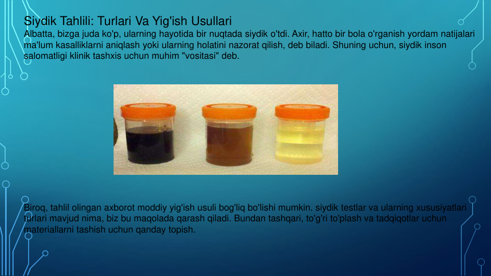 Siydik Tahlili: Turlari Va Yig'ish Usullari
Albatta, bizga juda ko'p, ularning hayotida bir nuqtada siydik o'tdi. Axir, hatto bir bola o'rganish yordam natijalari
ma'lum kasalliklarni aniqlash yoki ularning holatini nazorat qilish, deb biladi. Shuning uchun, siydik inson
salomatligi klinik tashxis uchun muhim "vositasi" deb.
Biroq, tahlil olingan axborot moddiy yig'ish usuli bog'liq bo'lishi mumkin. siydik testlar va ularning xususiyatlari
turlari mavjud nima, biz bu maqolada qarash qiladi. Bundan tashqari, to'g'ri to'plash va tadqiqotlar uchun
materiallarni tashish uchun qanday topish.
