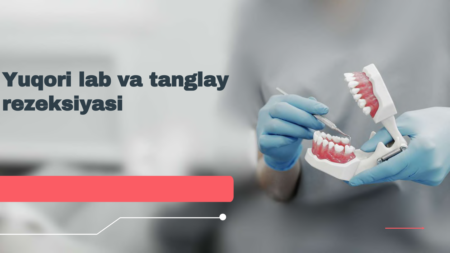 Yuqori lab va tanglay 
rezeksiyasi
